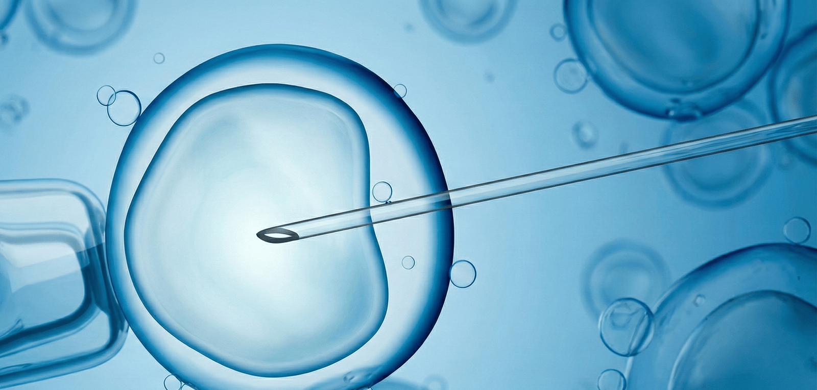 Μέθοδοι ιατρικώς υποβοηθούμενης αναπαραγωγής